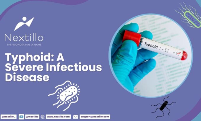 Typhoid A Severe Infectious Disease