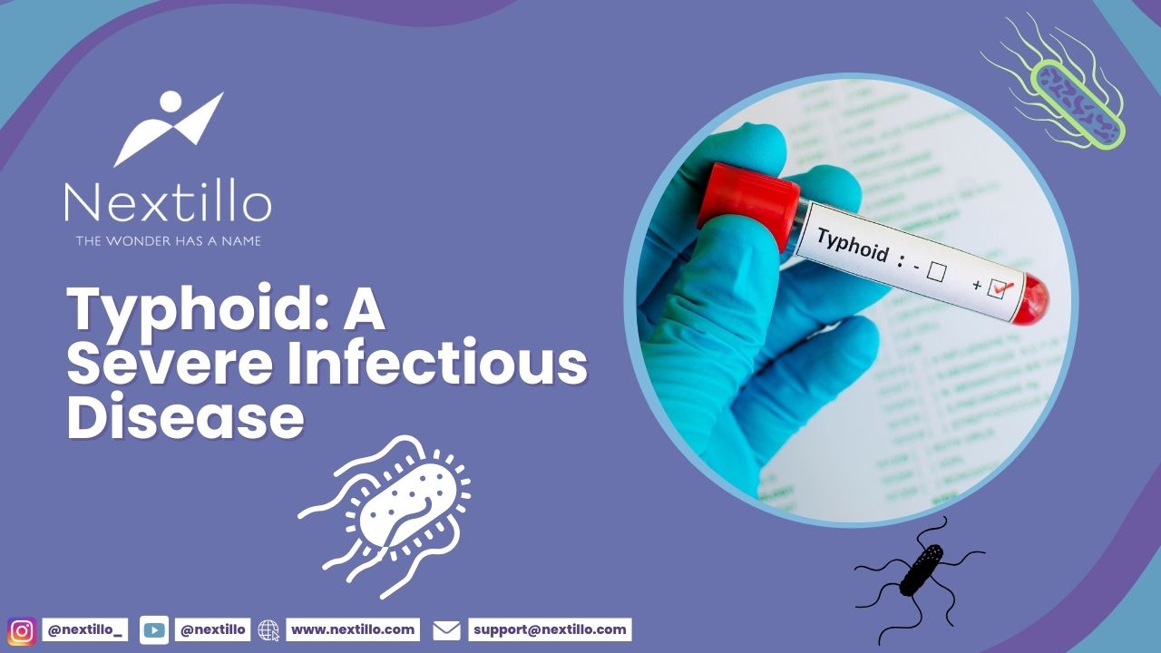 Typhoid A Severe Infectious Disease