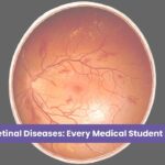 Common Retinal Diseases: Every Medical Student Should Know