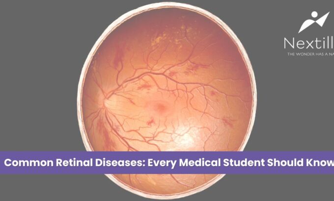 Common Retinal Diseases Every Medical Student Should Know