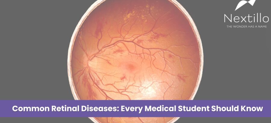 Common Retinal Diseases Every Medical Student Should Know