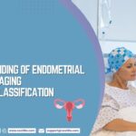 Understanding of Endometrial Cancer Staging and FIGO Classification